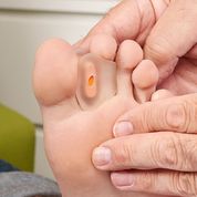 Lataa kuva Galleria-katseluun, Varpaanerottaja anatomisesti muotoiltu (räätälöitävä)